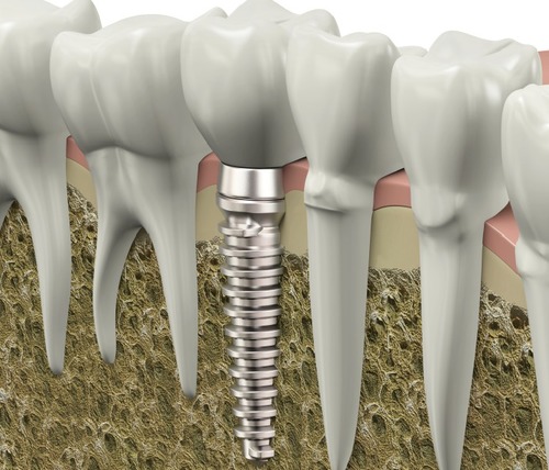 Dental Periodontal Institute Of Torrance ドクター山田 ドクターロー歯科医院 ロサンゼルスのタウン情報 現地日本語情報誌ライトハウス